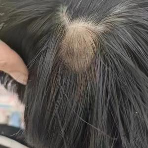 脱发拯救者头像