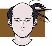 阿潘特秃毛的个人资料头像